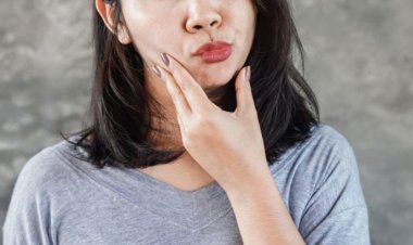 শীতে মুখ বেঁকে গেলে কী করবেন