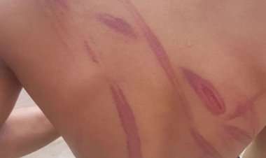 বরিশালে মোবাইল ব্যবহার করায় ছাত্রকে বেধড়ক পেটালেন শিক্ষক